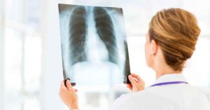 Akciğer Hastalıkları ve COVID tedavisinde Ozon Tedavisinin Önemi Nedir?
